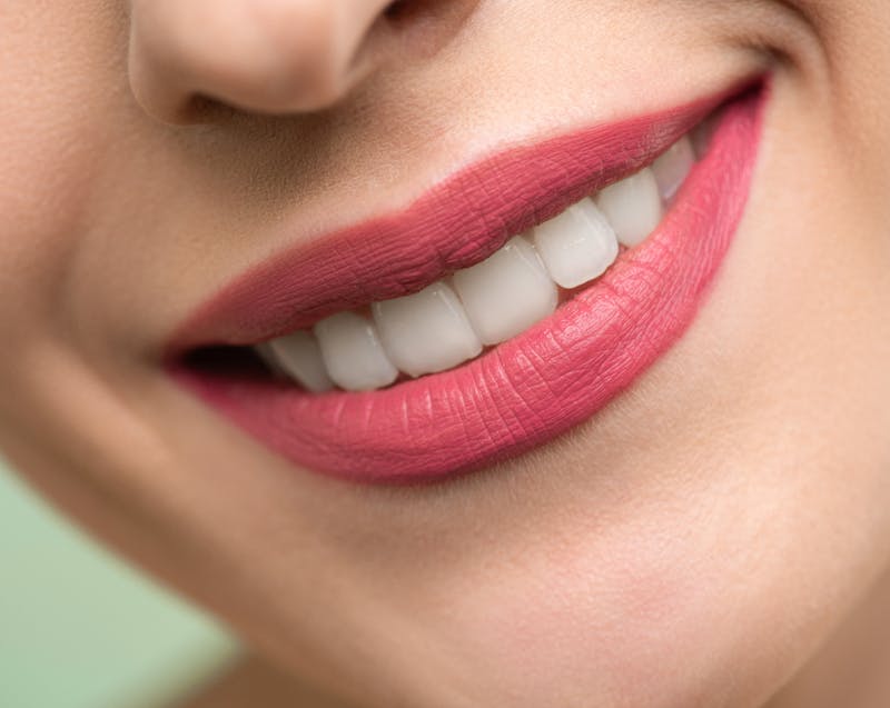 white teeth